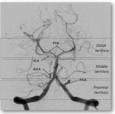Image result for Posterior Circulation