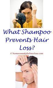 Pin On Hair Loss Stinks