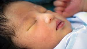 Kista adalah sebuah penyakit yang biasanya bersaran di tubuh wanita. Bayi Anda Kuning Perlukah Waspada