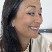 TOP 10 BEST Electrolysis Hair Removal near Alum Rock/East Foothills, Alum  Rock, CA