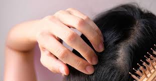 Hair Loss In Women 14 Treatments For Females