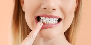 Periodontal Gum Disease Treatment in Bronx, New York.