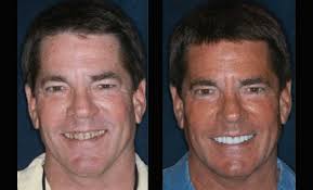 Cosmetic Dentist Plano