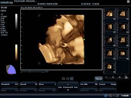 Dashboard result draw date view 4d directory 4d lucky number number pictures number history my favourite number past 4d result. Perdana 4d