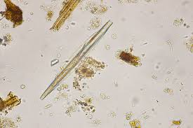 Image result for Entada bacillaris