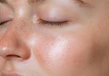 Healthy Skin Close Up Images – Browse 1,893,089 Stock Photos ...