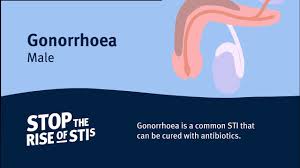 The stds chlamydia, gonorrhea, and trichomonas, which are caused by contracting common bacteria, can be cleared with a simple course of antibiotics. Stis Stop The Rise