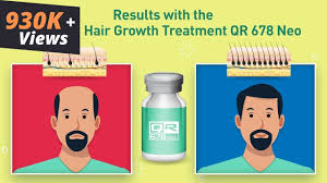 Hibiscus is thought to help stimulate hair follicles, increase follicle size, and increase hair growth. Best Hair Treatments In India For Hair Loss Hair Fall In Men Women Hair Growth Solution By The Esthetic Clinics