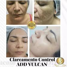 Bárbara Silva Estética Fácial & Corporal