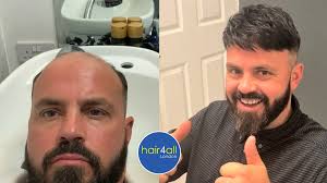 Michael (Mike) Rushton |10yearsyoungerin10days