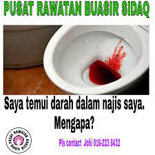 Berak berdarah selalunya memberi anggapan yang kita ada masalah pada saluran pencernaan. Pusat Rawatan Buasir Sidaq Ada Banyak Sebab Mengapa Berlaku Pendarahan Di Dalam Najis Apa Yang Para Doktor Akan Lakukan Ialah Bermula Dari Mengambil Sejarah Terperinci Berkenaan Dengan Cara Pembuangan Najis Pesakit