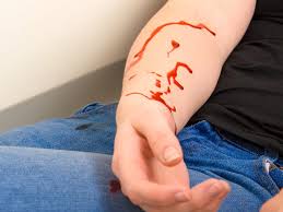 Blood hurt by culoso on deviantart from orig11.deviantart.net sep 24, 2018 · antibiotics can hurt your health if you don't have an infection. Bleeding To Death Am I At Risk And How Can I Stop It