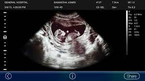 We did not find results for: Ultrasound Pregnancy Prank Lite 1 3 Free Download