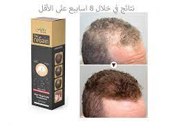 علاج الجديد reGAIN لإنبات الشعر - لكل انواع الصلع - عمري