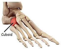 Problems with the top of the foot can be due to dropping something on the area. Pain On Outside Of Foot Causes Symptoms Treatment