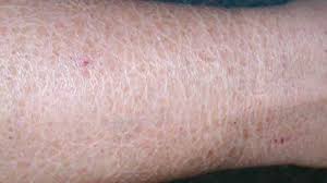 Here are five skincare habits to avoid to prevent rashes, breakouts, and irritation. Sensitive Skin 10 Causes Treatments And More