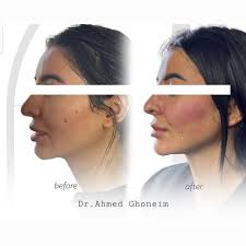 𝘿𝙧. 𝘼𝙝𝙢𝙚𝙙 𝙂𝙝𝙤𝙣𝙚𝙞𝙢 (@dr.ahmed_ghoneim) • Instagram photos and  videos