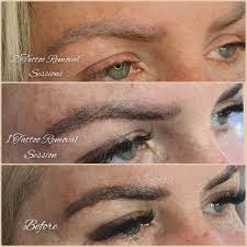 Maybe you would like to learn more about one of these? Pink And Blue Eyebrows After Microblading Eyebrow Tattoo Elite Look