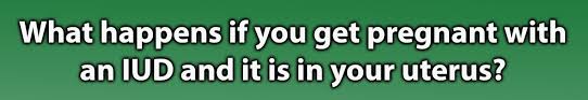 My friend just gave birth a couple of days ago, and she got pregnant using an iud. I Got Pregnant With An Iud And My Tiktok Story About It Went Viral