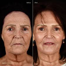 We love all of our patients at the clinic, but sometimes you get one that  is just even extra special