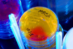 Maybe you would like to learn more about one of these? Uf Study Silent Mrsa Carriers Have Twice The Mortality Rate Of Adults Without The Bacteria Uf Health University Of Florida Health