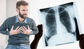 Conventionally thoracic biopsies are performed using ct guidance. Lung Cancer The Early And Advanced Symptoms You Should Not Ignore Express Co Uk