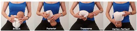 Optimal Fetal Position What You Need To Know Pregnancy
