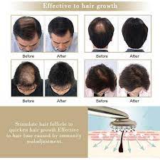 Does scalp massage for hair growth work? Laser Hair Growth Comb Photon Light Therapy Hair Brush Scalp Massage Comb Anti Hair Loss Treatment Massager From Cybeautywholeseller 89 35 Dhgate Com