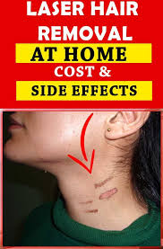 You can be confident in knowing that only our doctors that are highly experienced using lasers perform treatments and your safety and satisfaction is a top priority. Is Laser Hair Removal Safe Does Laser Hair Removal Cause Cancer Laser Hair Removal Hair Removal Diy At Home Hair Removal