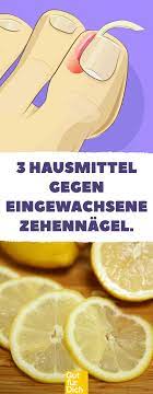 ohne op 3 hausmittel gegen eingewachsene zehennagel zehennagel eingewachsener zehennagel zehennagel zehennagel eingewachsene