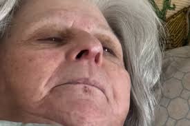 Fundraiser by Susan Honig : Help My Mother Battle a Debilitating Illness