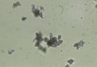 Microscopic Urinalysis Part 2 Crystals And Casts Amorphous Urates Appear In Acidic Urine Medical Laboratory Medical Laboratory Science Laboratory Science