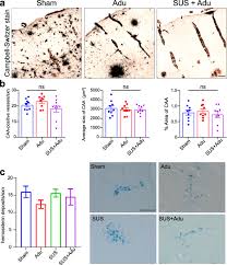 After entering into a partnership with biogen in 2007. A Comparative Study Of The Effects Of Aducanumab And Scanning Ultrasound On Amyloid Plaques And Behavior In The App23 Mouse Model Of Alzheimer Disease Alzheimer S Research Therapy Full Text