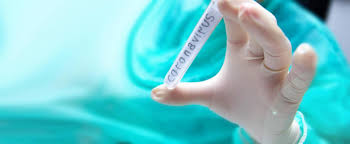 Coronavirus folge ich folgen folgen. Information Regarding Covid 19 Coronavirus Sars Cov 2