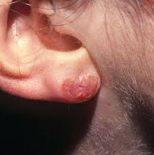 Ear Piercing Questions