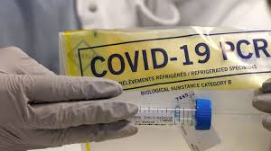 *des laboratoires d'analyses franciliens feraient débourser à leurs patients près de 100 euros pour un simple test pcr. Pgshi0a Qakk9m
