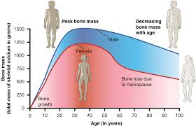 File 615 Age And Bone Mass Jpg Wikimedia Commons