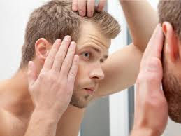 In the most extreme cases, infection and scarring may occur,. Chemical In Mcdonald S Fries Could Help Regrow Hair Scientists Say