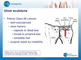 Palmer classification for triangular fibrocartilage complex (tfcc) abnormalities is based on the cause, location, and degree of injury 1: Acute Triangular Fibrocartilage Complex Injuries Treatment Managem