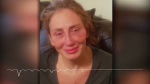 يعد برنامج صبايا الخير من أكثر المواضيع شهرة وإثارة للجدل الذي يستعرضه. Ø±ÙŠÙ‡Ø§Ù… Ø³Ø¹ÙŠØ¯ ØªØ­ÙƒÙŠ Ø¨Ø§Ù„ØªÙØ§ØµÙŠÙ„ Ù‚ØµØ© Ø¥Ø²Ø§Ù„Ø© Ø£Ù†ÙÙ‡Ø§ Ø¨Ø§Ù„ÙƒØ§Ù…Ù„ Youtube