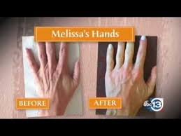 They will most definitely make your hands look older than they are. How To Repair Aging Hands And Make Your Hands Look Younger