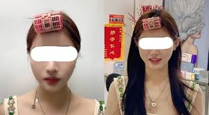I just couldn't help but rant about this. Elf Ears Are Trending In China People Are Undergoing Surgery To Get Them