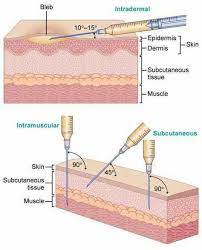 Attack Angle For Intramuscular Subcutaneous Intradermal Injections Nurse Medical Nursing School Studying
