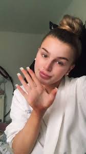 Ultimate Guide to Contraceptive Implants