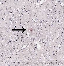 Developmental abnormalities were produced in mouse fetuses after chronic feeding studies. Congo Red Stain Kit Amyloid Stain Ab150663 Abcam