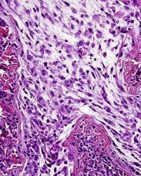 Image result for Neurotheca