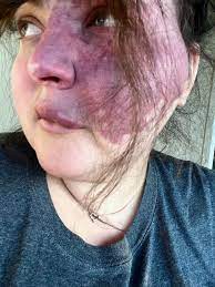 Crystal Hodges - Without meeting me, it's easy to make assumptions about my  life. Why? Because I don't look like most people. Over the years I've had  many people come up to