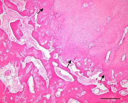 We did not find results for: Photomicrograph Of A Section Of Radius From A Miniature Scottish Download Scientific Diagram