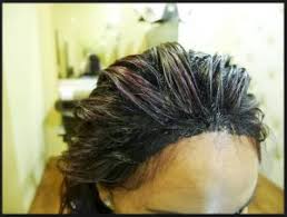What you need to do is click to. Removing Hair Dye Color From Your Skin Nlw