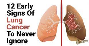 Regardless, the best chances of beating lung. 12 Early Signs Of Lung Cancer To Never Ignore